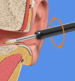 Wi-Fi-Visible-Wax-Elimination-Spoon-USB-1080P-HD-Load-Otoscope2_11zon